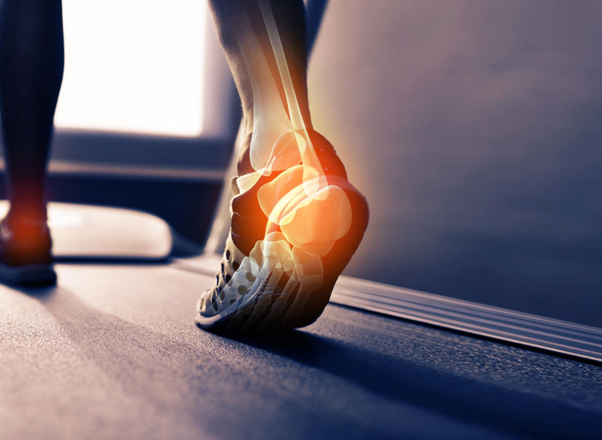 Achilles Tendinopathy (AT)