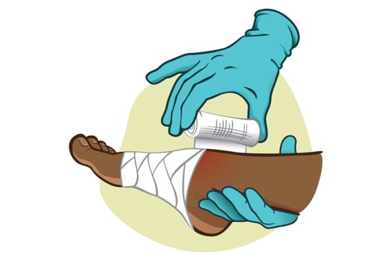 Post-Operative Foot & Ankle Wound Care Guidelines