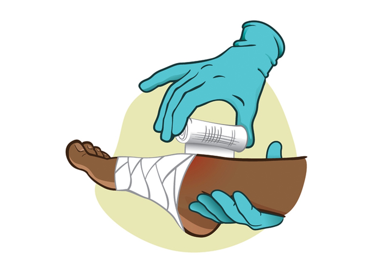 Post-Operative Foot & Ankle Wound Care Guidelines